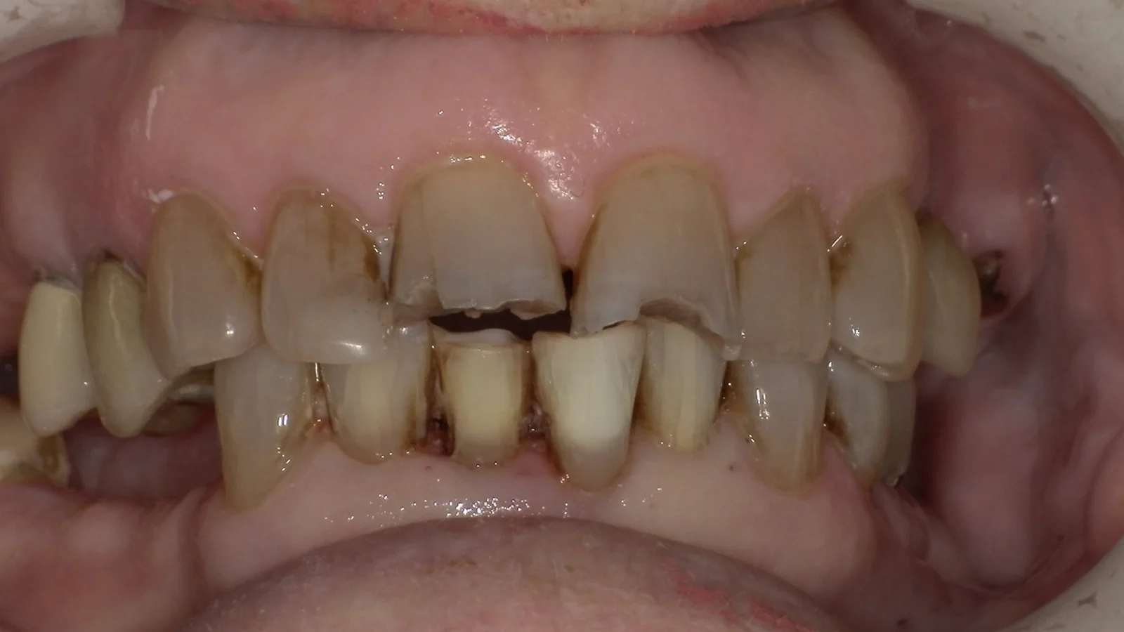 Before treatment