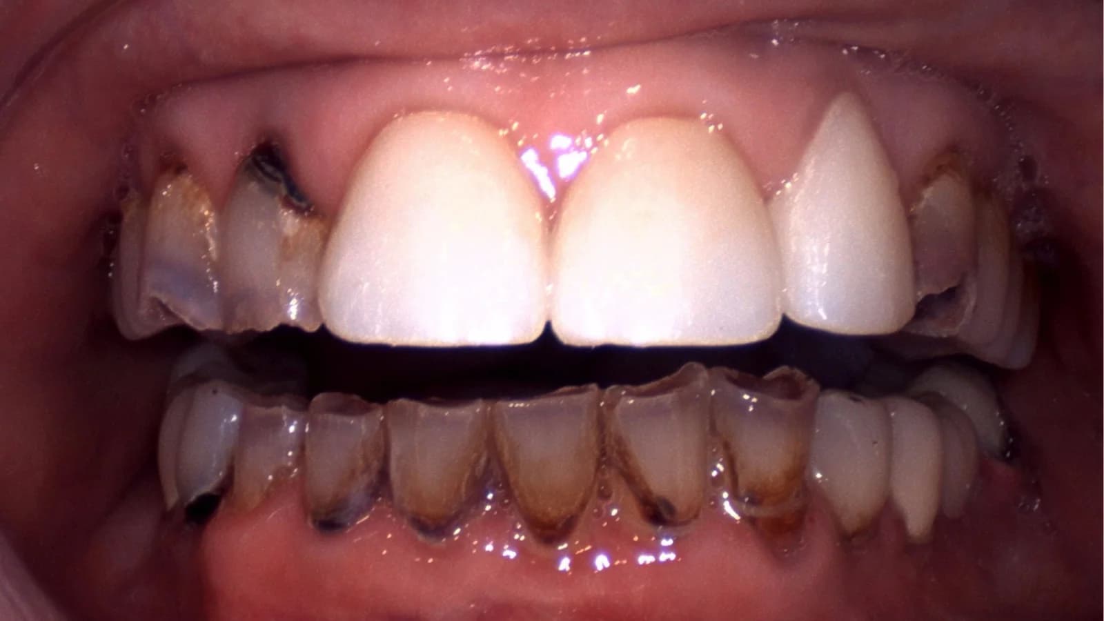 Before treatment