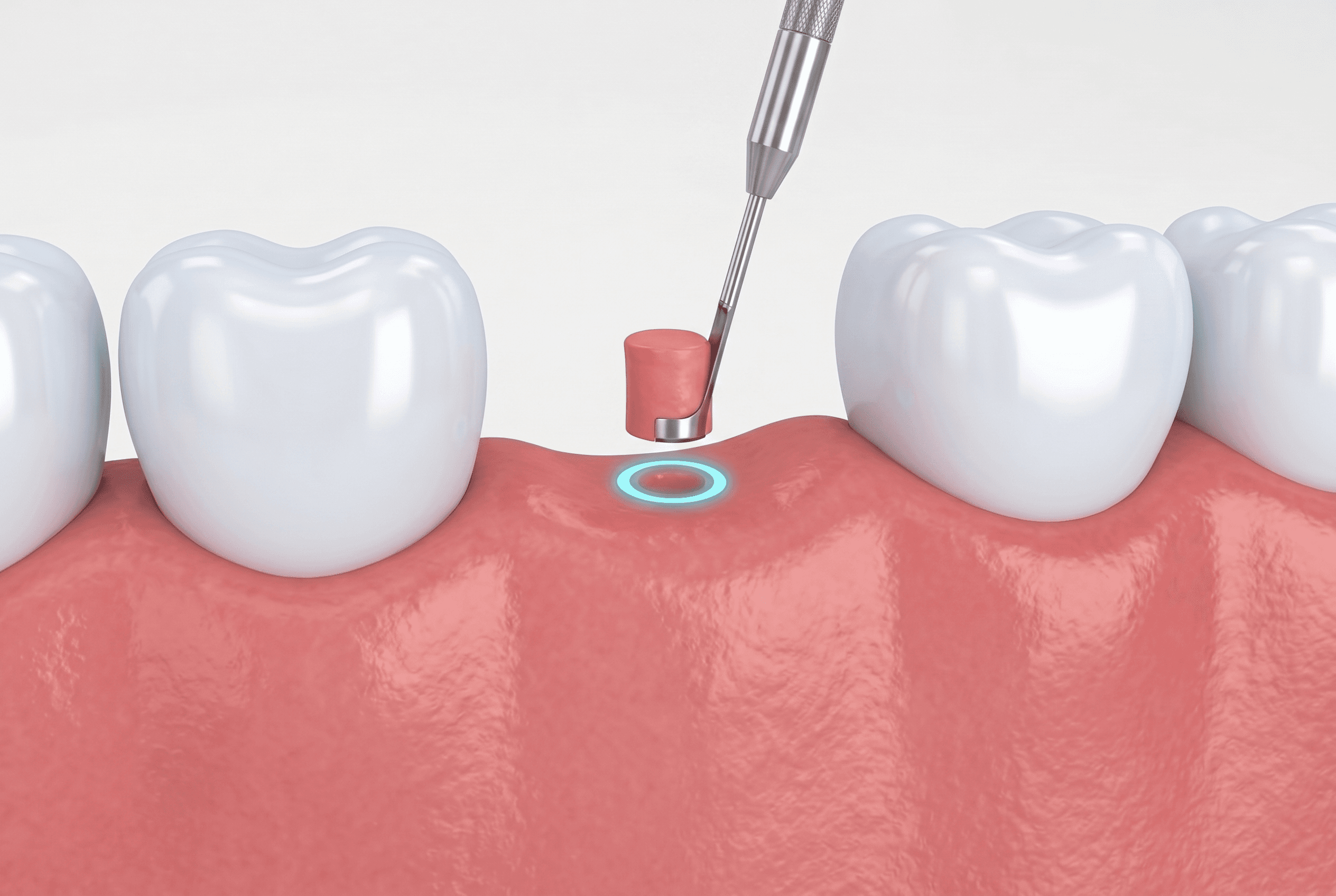 Educational illustration showing biopsies
