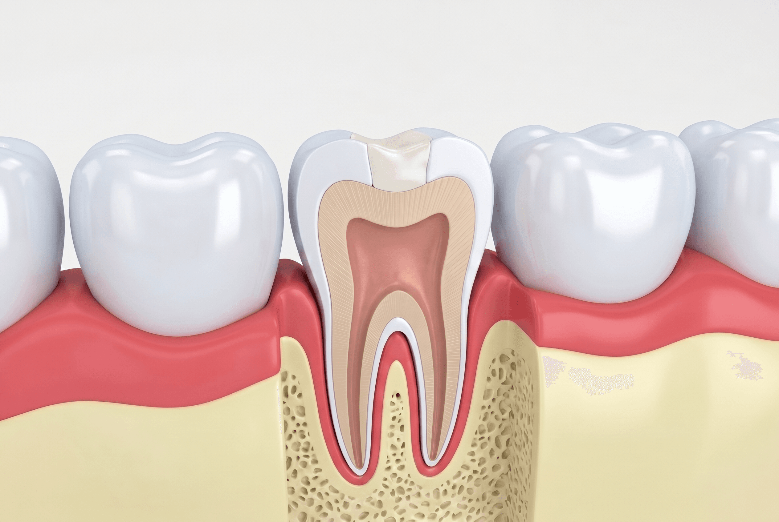 Educational illustration showing composite fillings